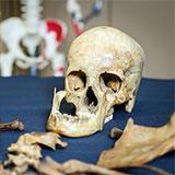 Skull bone among other skeletal remains